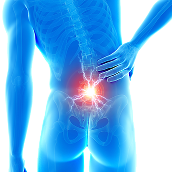 Arthrose