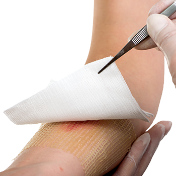 Arthrose