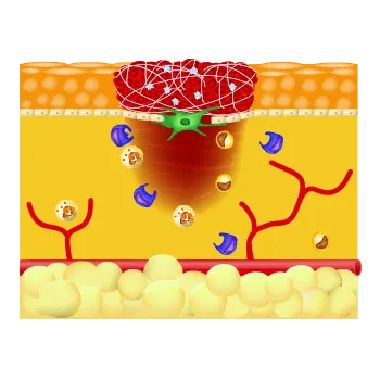 schematic scar