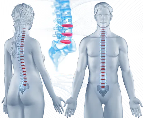 Wirbelsäule Bandscheiben Rückenschmerzen